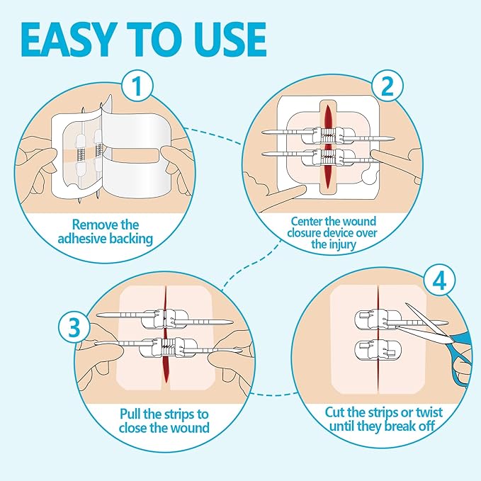 Senvok Butterfly Bandaids for Wound Closure, 2 Pcs Zip Stitch Wound Closure Strips, Surgical Laceration Repair Without Sew - Quick Clot - Emergency Wound Closures Device (PU)