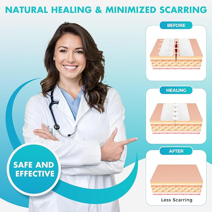 Zip Stitch Wound Closure Strips Extra Large | 2-Pack Stitchless Butterfly Bandages | Adjustable Tension for Painless Laceration Repair, Post-Surgery Care & Emergency First Aid