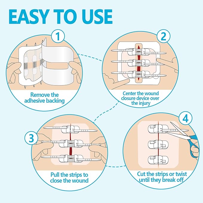 Zip Sutures Butterfly Bandaids – 4-Pack Assorted Sizes, Emergency Wound Closure Kit for Surgical Laceration Repair Without Stitches, Fast Hemostasis Adhesive Strips Bandages (PU)
