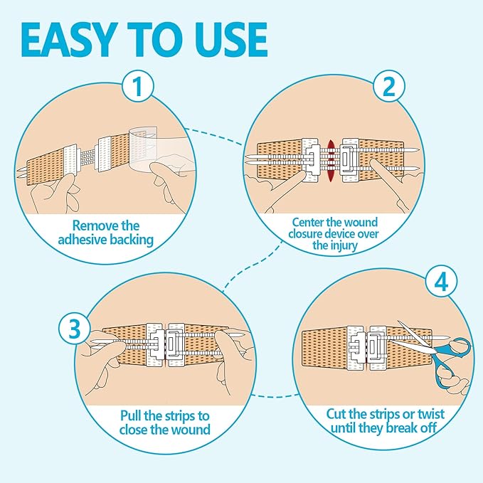 Wound Closure Device 4 Pcs - Zip Sutures & Butterfly Bandage | Stitchless Wound Repair, Rapid Hemostasis for Hiking, Camping, Wilderness Survival | Outdoor First Aid Essentials