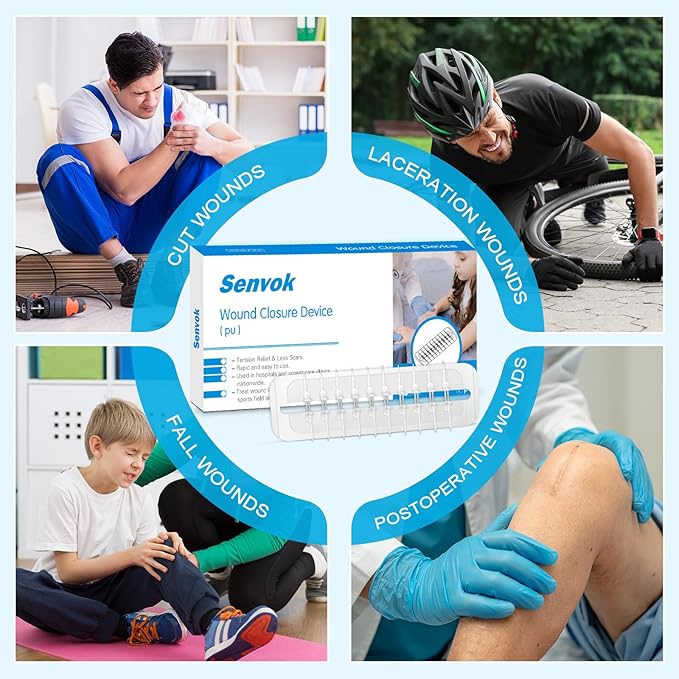 Large Butterfly Bandages for Extra Large Wounds | Steri Strips Wound Closure - Surgical-Grade Stitchless Laceration Repair & Rapid Hemostasis, Emergency First Aid Care